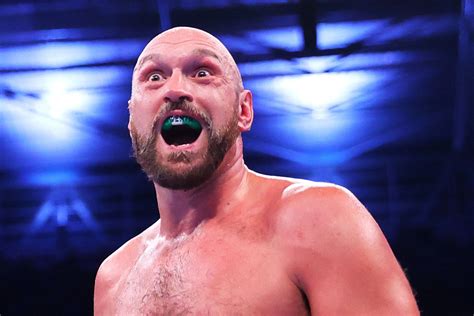 Tyson Fury.